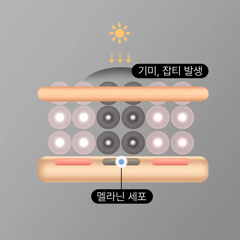 확장된 피부 혈관