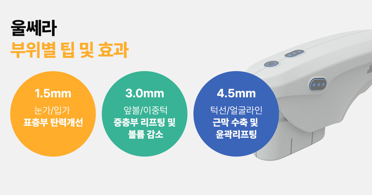 울쎄라 부이별 맞춤 팁과 정품 팁의 중요성