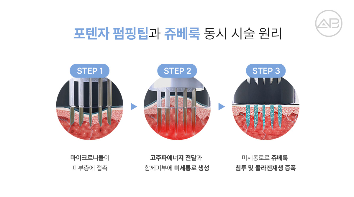 포텐자 펌핑팁과 쥬베룩을 함께 받으면?