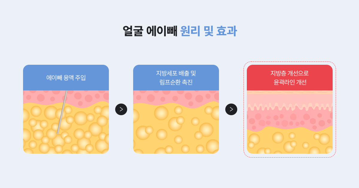 윤곽주사는 어떤 원리로 라인을 바꿀까?