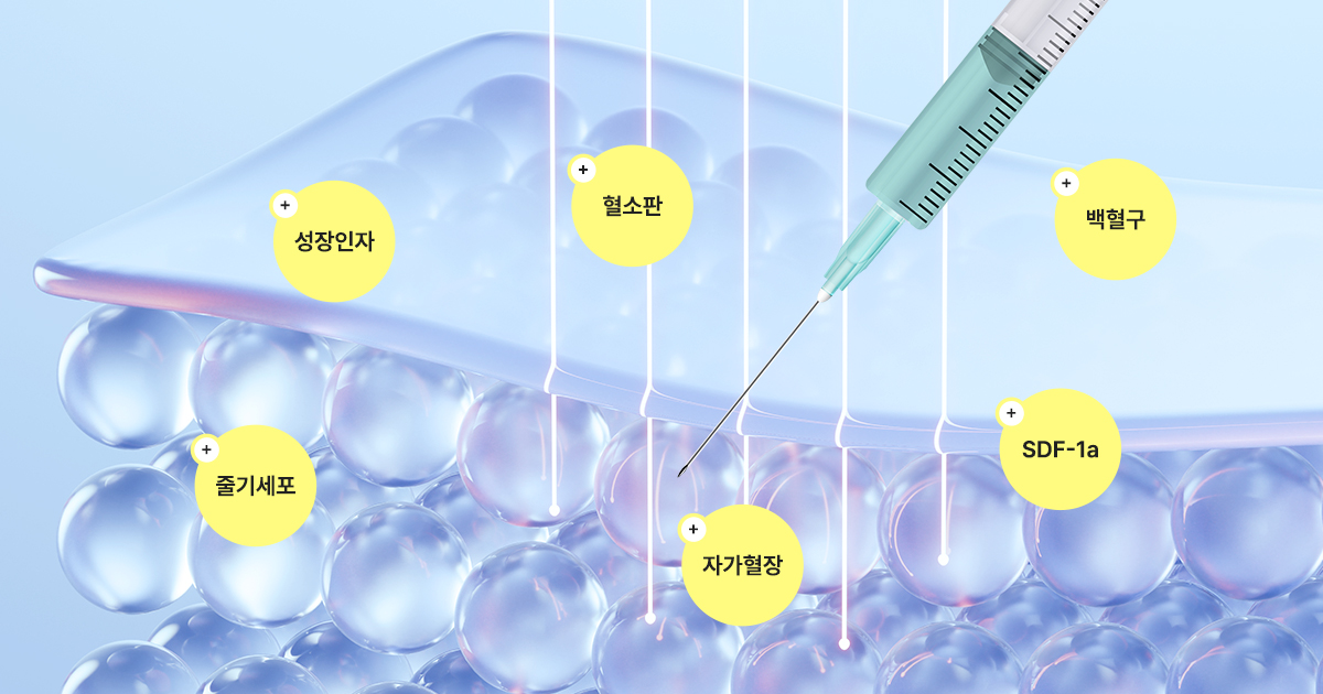 리턴셀 줄기세포 피부주사란?