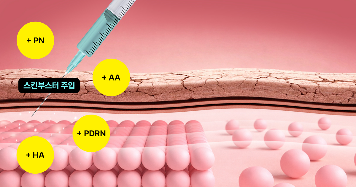스킨부스터가 필요한 순간과 기대할 수 있는 변화