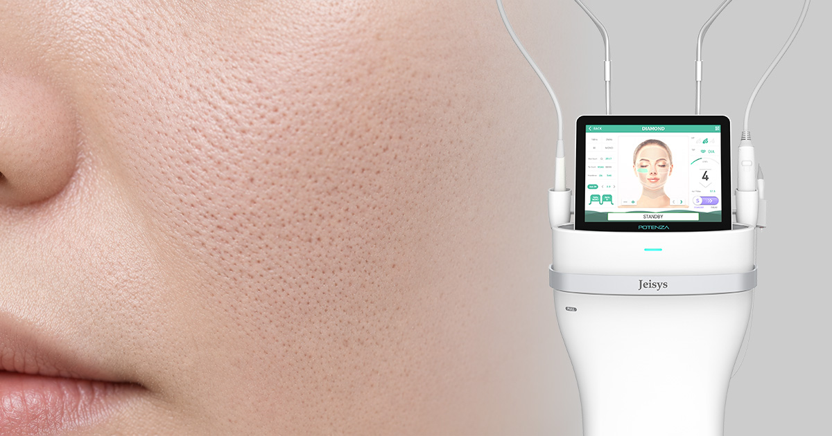 포텐자 모공팁, 펌핑팁 차이? 쥬베룩과 함께 받기 좋은 이유 관련 이미지