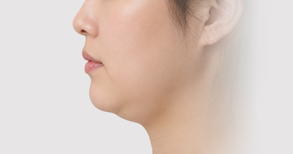 온다리프팅 시술 전후, 실제 후기로 보는 온다리프팅 효과 관련 이미지
