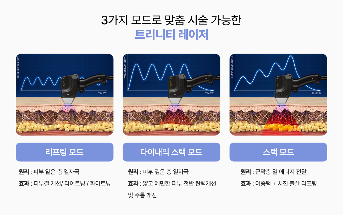 트리니티 레이저 모드별 효과