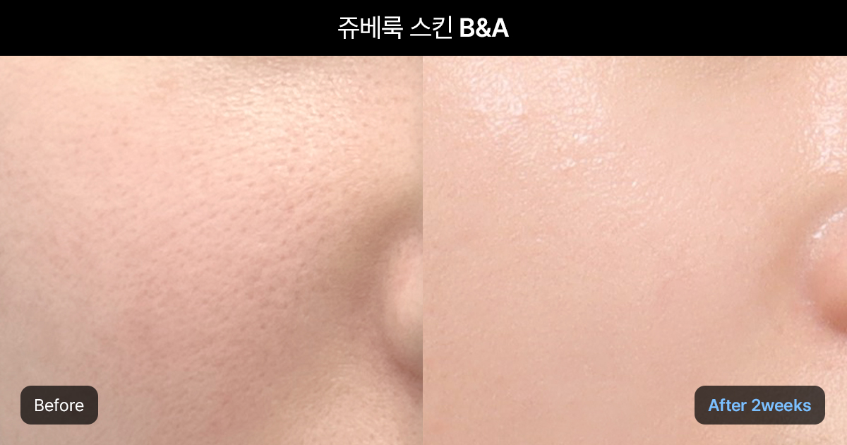 쥬베룩 스킨의 핵심 효과 및 추천 대상