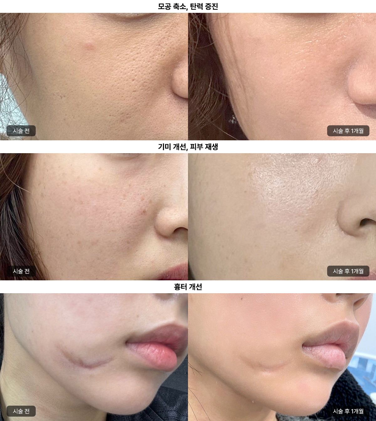 포텐자, 어떤 피부 고민에 효과적일까요?