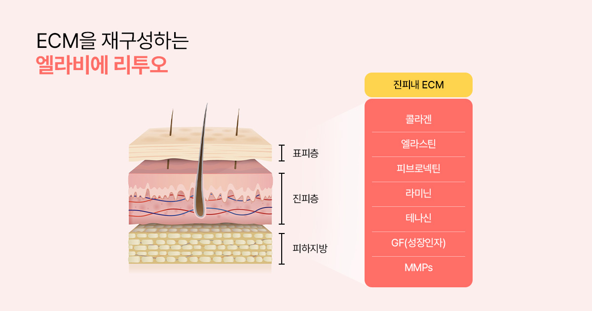 ECM 부스터 혁명, 엘라비에 리투오가 특별한 이유