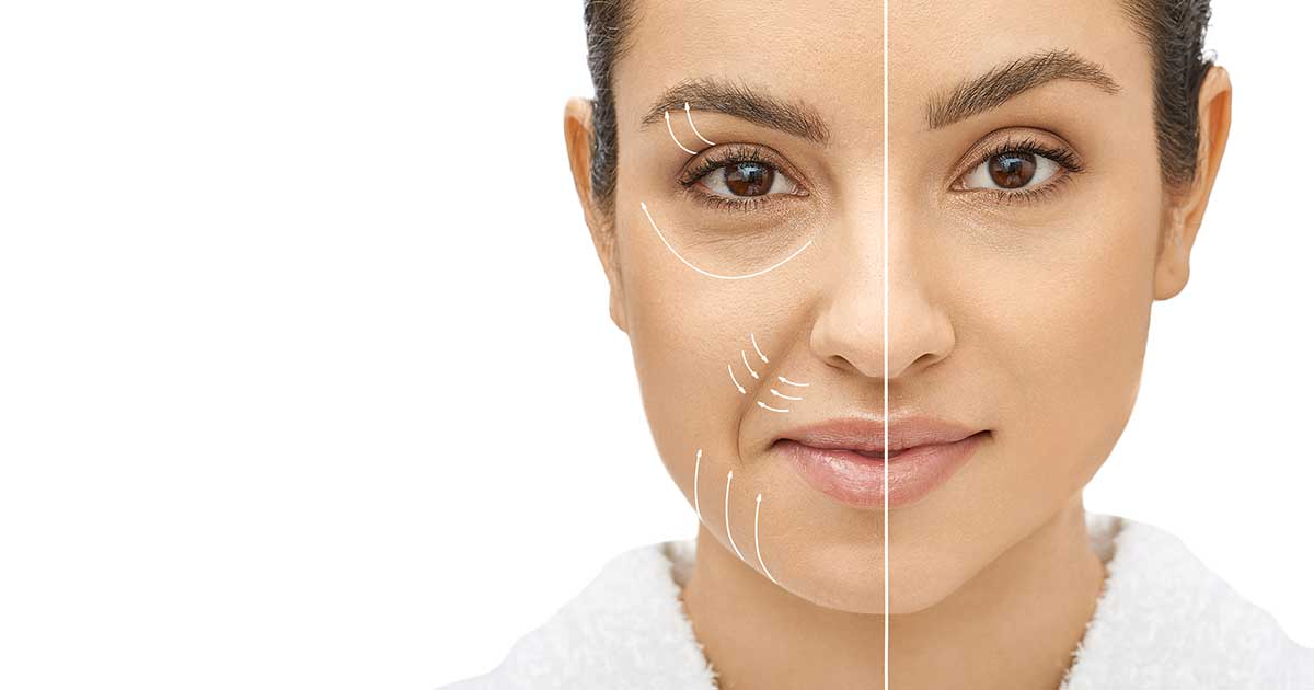 울쎄라 시술, 피부 탄력과 주름 개선 효과는 어디까지?