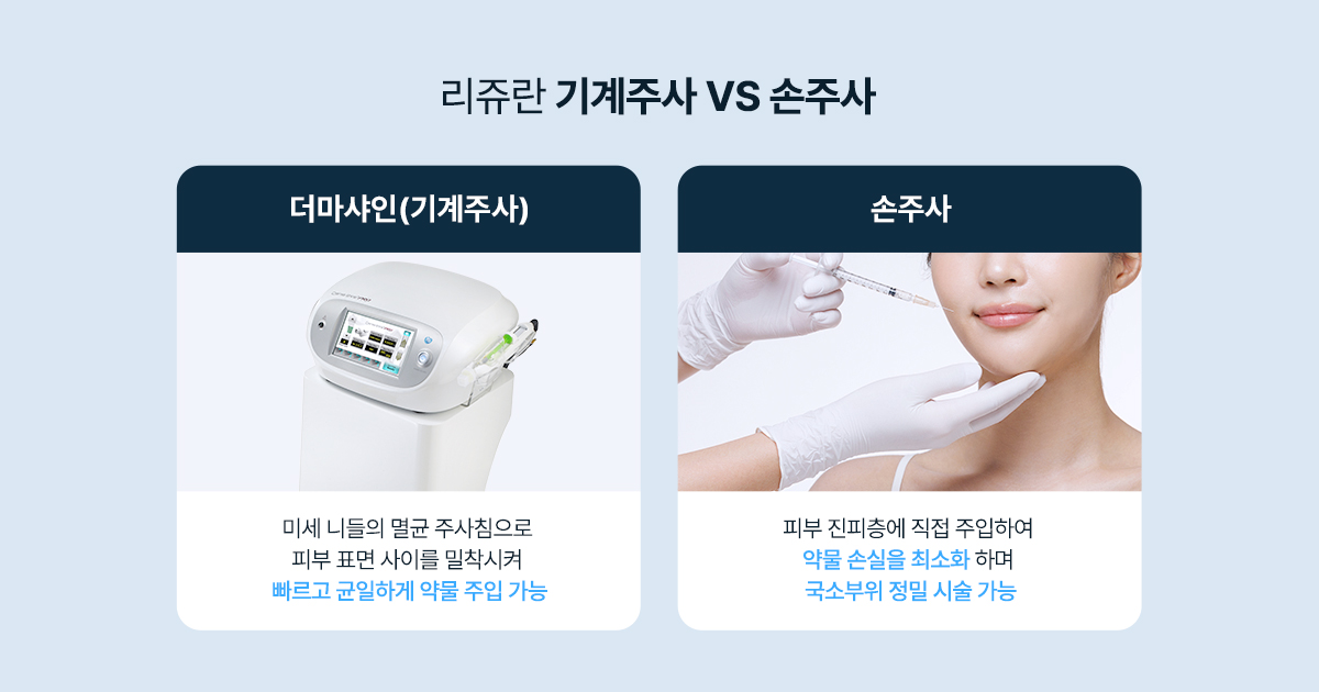 주입 방식: 리쥬란 손주사 vs 리쥬란 기계주사