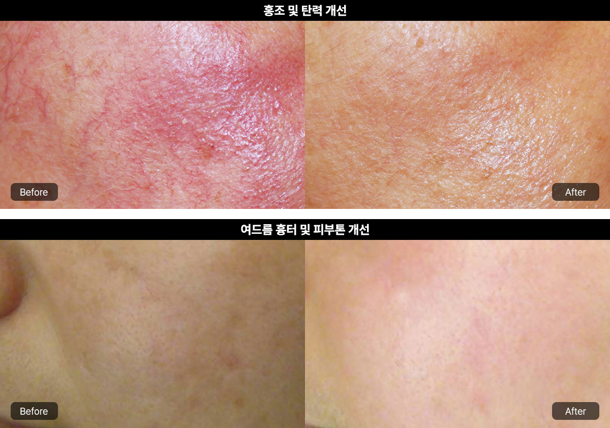 엑셀V플러스란?