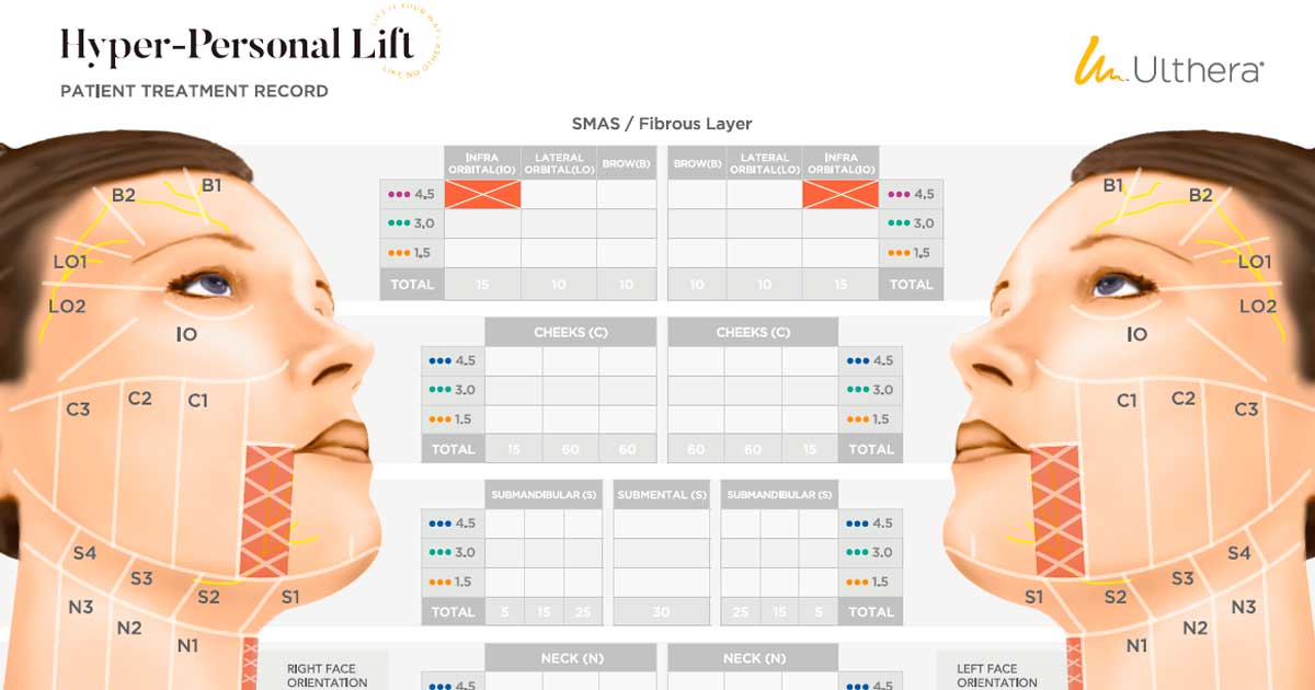 울쎄라 시술, 어떻게 진행될까? 과정·비용·효과 총정리