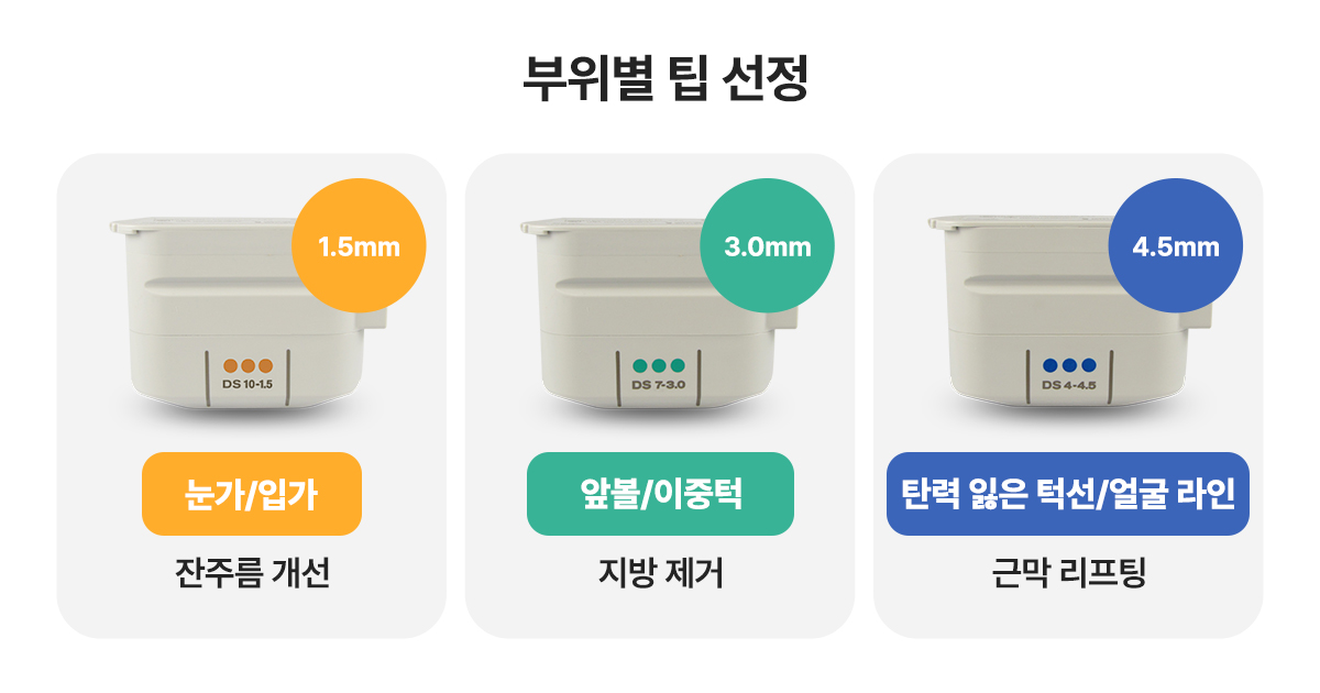 울쎄라 부작용을 줄이는 방법