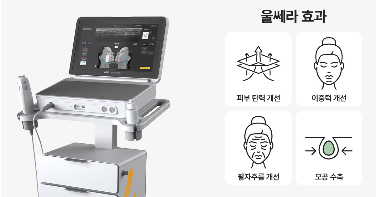 울쎄라피 프라임 시술 원리 및 효과