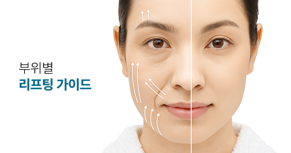 실리프팅 효과를 떨어뜨리는 주요 원인