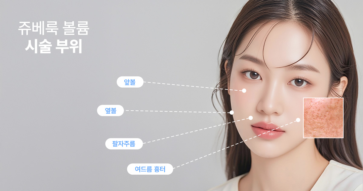 쥬베룩 볼륨 시술 적합 부위