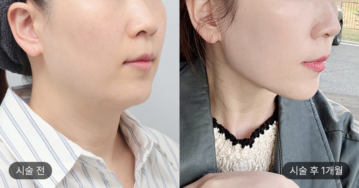 효과 발현 및 유지기간, 어떻게 달려졌을까?