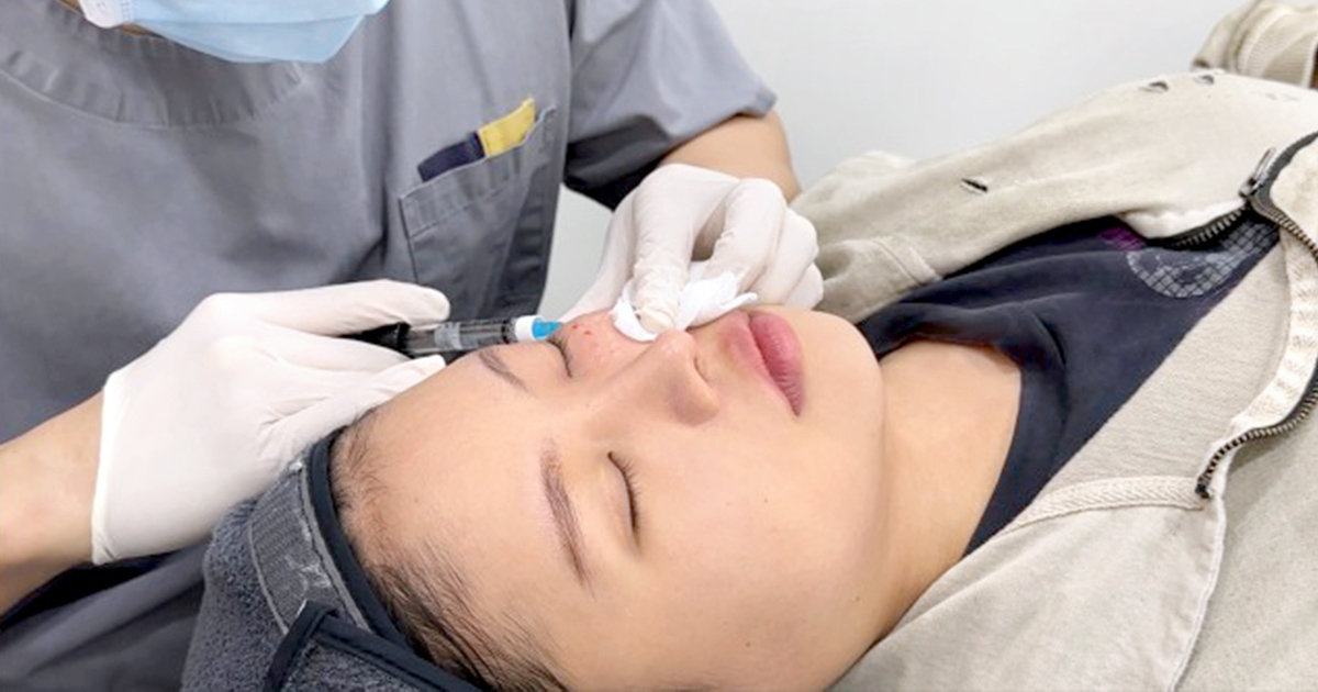 보다 안전하고 높은 리쥬란 시술 효과를 구현하기 위해서는?