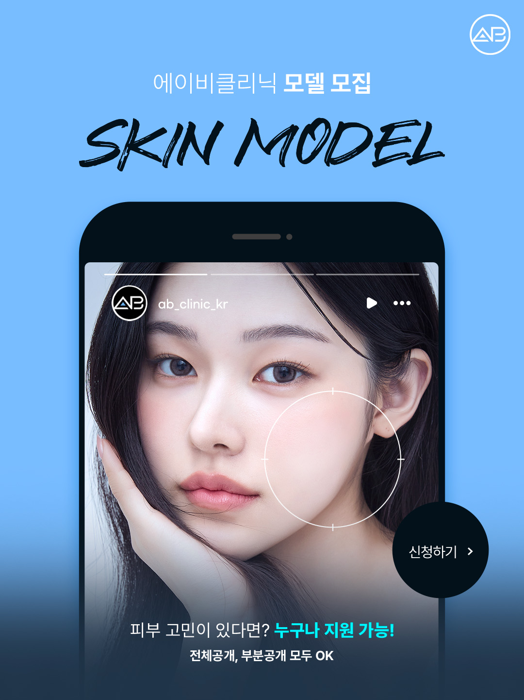 에이비클리닉에서 피부 시술 모델을 모집하고 있습니다.