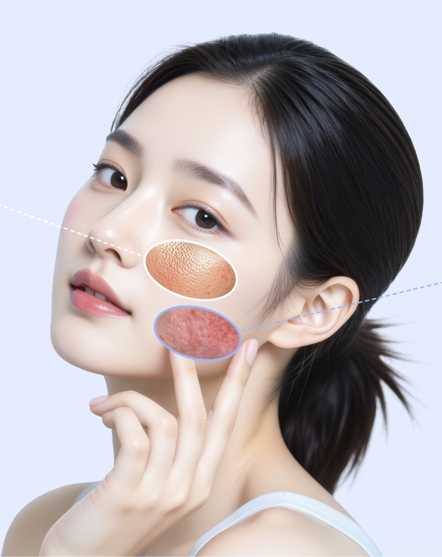 쥬베룩 - 에이비 피부과