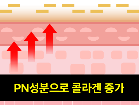 리쥬란 시술