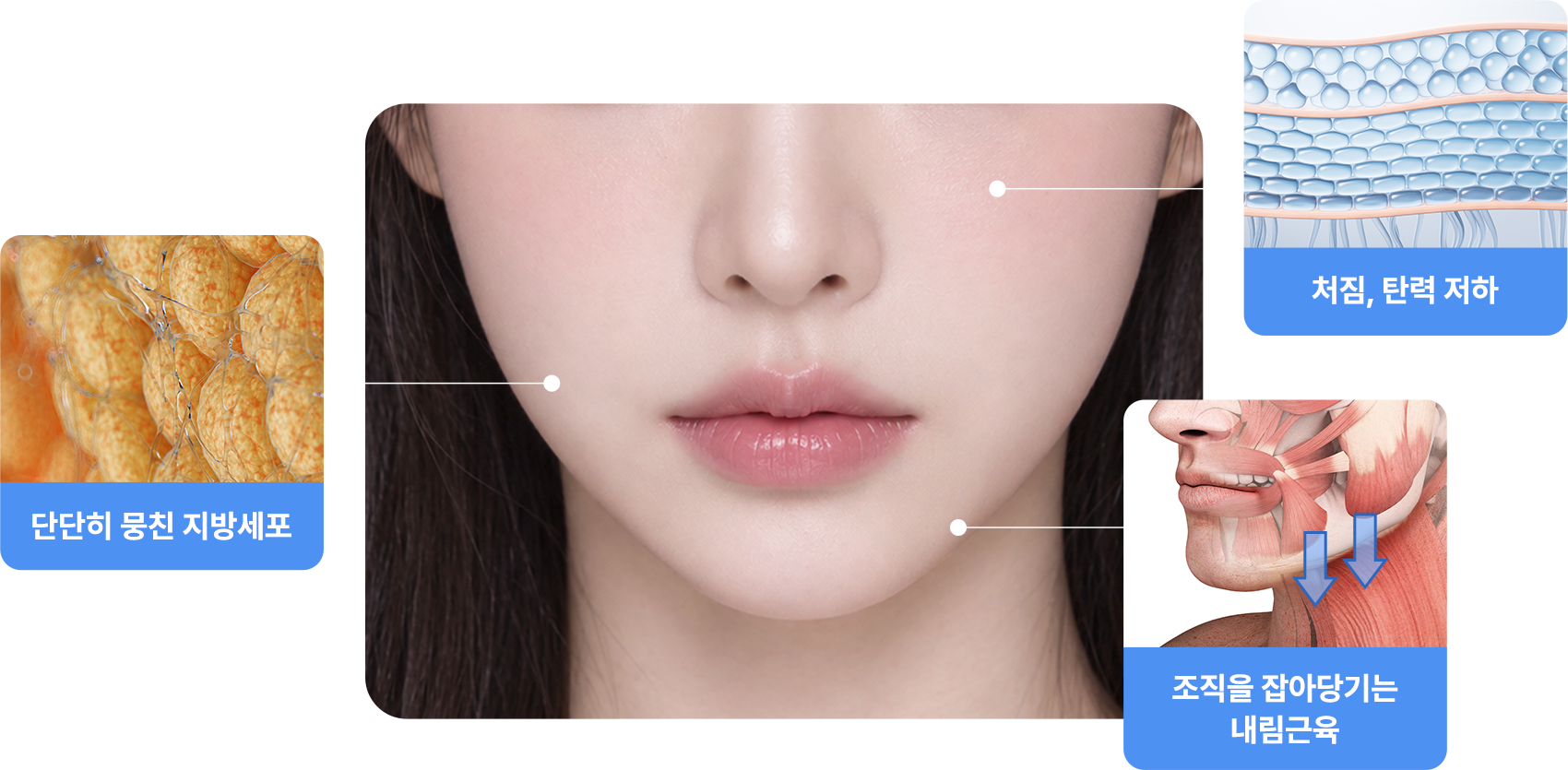 V라인이 될 수 없었던 이유