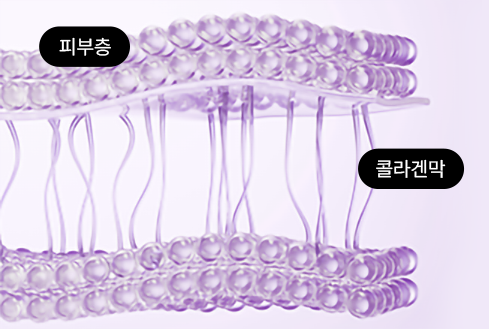 콜라겐 맥스 써마지 피부층 시술 전