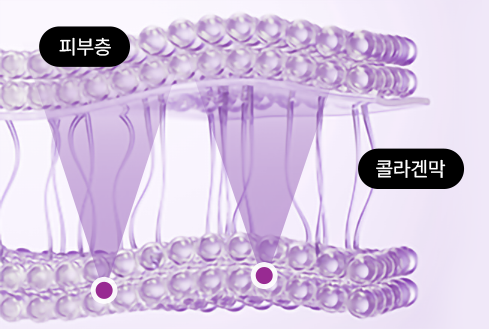 콜라겐 맥스 써마지 피부층 고주파 전달