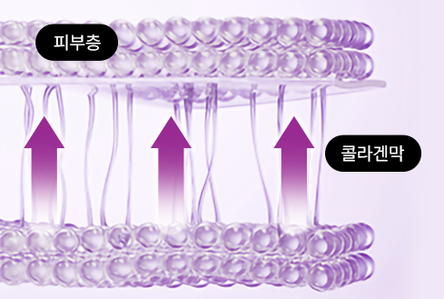 콜라겐 맥스 써마지 피부층 시술 후