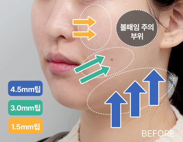 Only AB - 에이비 피부과