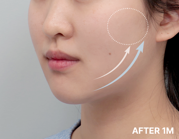 Only AB - 에이비 피부과