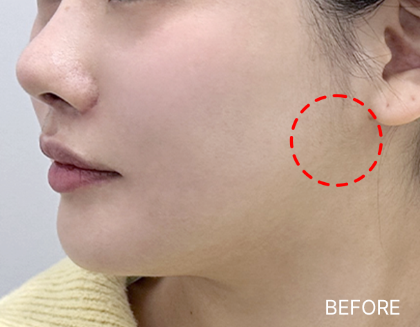 Only AB - 에이비 피부과