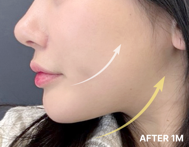 Only AB - 에이비 피부과