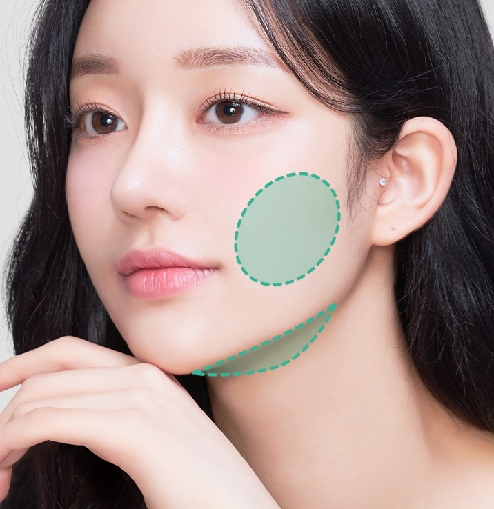 3.0mm팁 - 에이비 피부과