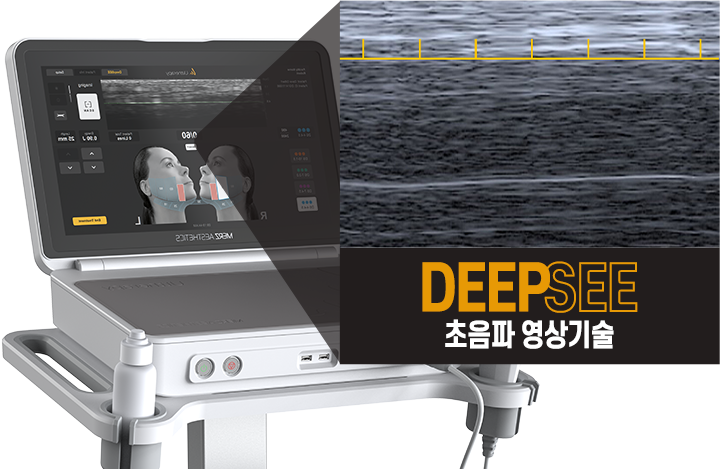 DEEP SEE 기술 - 에이비 피부과